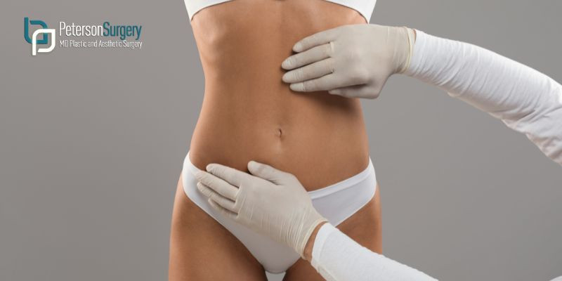 BODY CONTOURING VS LIPOSUCTION: UNDERSTANDING THE KEY DIFFERENCES – KELOWNA BODY CONTOURING